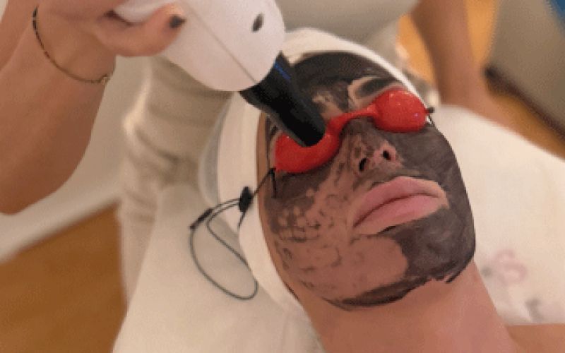 Carbón activo, el aliado detox para limpiar tu piel en profundidad